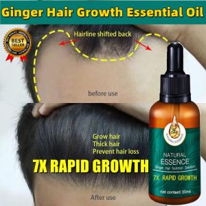 Hair Growth Serum Ginger Hair Treatment hair 7X Rapid Growth for Thicker Healthier Hair