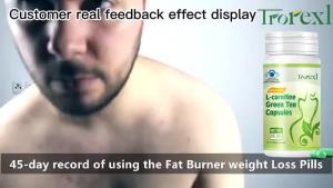 Trorexl L-carnitine Green Tea Fat Burning Fat Burner ❤️‍Organic Vegetarian 60 Capsules weight Loss Pills ❤️‍Best Belly Fat Burner