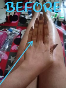 TCA 35% Peeling Kelupas Kulit - Dijamin Ori - Kulit Kelupas dalam Seminggu - Membantu Memutihkan - HBReal Testy Dari Owner Nya Langsung (EXPORT)