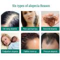 Hair Growth Serum for Thicker, Longer, Fuller Hair - Prevents Loss and Thinning with Vitamin-Rich Natural Treatment. 