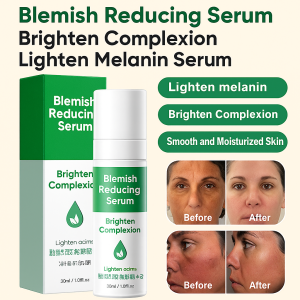 Pomei Doctor 377 Whitening Spot Serum for Women Adults Diminish Dark Spots Brighten Dull Skin Create Flawless Skin Moisturizing and Delicate