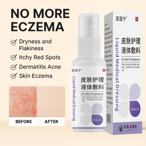 สเปรย์ดูแลผิวหนังสำหรับโรคผิวหนังอักเสบ สเปรย์บรรเทาเคือง ครีมทาผิวสำหรับรักษาอาการคัน ช่วยให้ผิวรู้สึกสบาย ไม่ระคายเคือง皮肤护理液体敷料