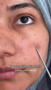 CELIMAX The Vita-A Retinol/ Retinal Shot Tightening Serum/ Booster 15ml
