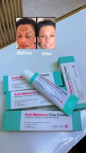 CARENEL Anti-Melasma Cica Cream 40ml Kem dưỡng da làm sáng tông màu