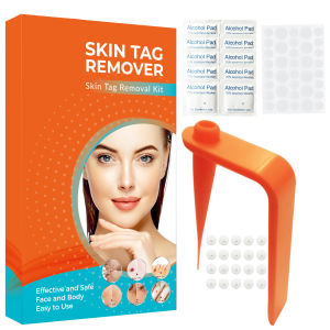 Painless Safe Skin Tags Remover Device Kit Micro Tags Sized(2mm to 4mm) Warts Remover Original Skin Band Tool Set