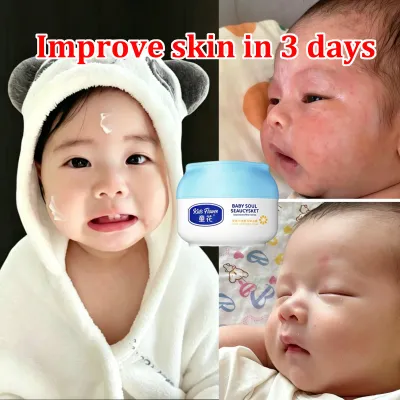 Baby Daily Moisture Hydrating Facial Cream Baby Skin Healing Cream Whitening and moisturizing preventing skin dryness reducing itching alcohol-free mild and non-irritating
