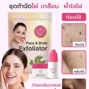 แต้มไฝ ซองใส ❤ ชุดแต้มไฝและลดฝ้า อ่อนโยน ไม่กระตุ้น/ทำให้เมลานินจางลง ผลิตภัณฑ์แต้มไฝ (จัดส่งเร็ว) 点痣祛斑护肤盒