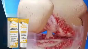 Ximonth Bee Venom Joint Repair Gel Relieve Cervical Spine Shoulder Neck Wrist Soreness Discomfort Joint Care Gel