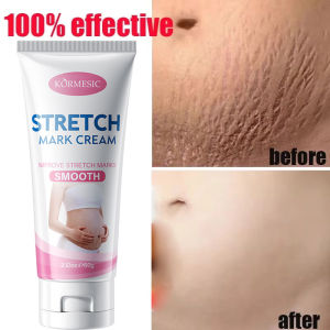Stretch Marks Permanent Removal Cream Maternity Pregnant Women Pregnancy Anti-Winkle Smooth Repair Firming Skin Body Skin Care2026