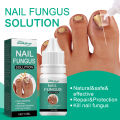 Eelhoe Nail Fungus Solution Nail Fungus Treatment Essence Serum Hand Care Foot Fungal Removal Repair Gel Anti-infective Paronychia Onychomycosis Nail Repair Liquid Nails Solution Fungal Nail Antifungal Anti Fungus Toe Nail Care Hand And Foot Onychomycosis. 