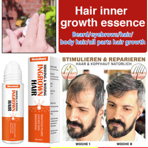 arcade Month ingrown hair serum