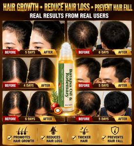 ✨Essence For Hair/ Growth Oil For Hair/ Improve Hair Condition/ Boost Growth Of Grey Hair/ Dry Hair/ Rollerball/ Refreshing 【7 Days 80% More Hair】Batana Hair Growth Oil