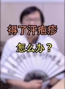 汗疱珍抑菌膏Spot Genuine Sporosclerosis Ointment Hand Dyshidrosis hands itching peeling 汗疱疹水泡疹云南本草皮肤汗泡瘙痒起疹子感染皮肤。。。