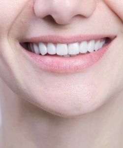 Cleardent Denture Adhesive Cream Fix & Go 40g – Secure Hold for Comfortable Dentures