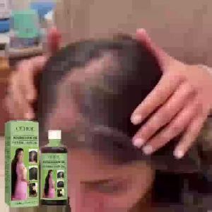 ✅ Genuine Discount ✅OUHOE Herbal Hair Oil Gentle Nourishing Scalp Strengthening Hair Cleansing Scalp Care Smooth Hair Oil