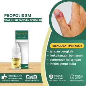Obat Kuku Tangan Bengkak Dan Bernanah Obat Cantengan Obat Cantengan Jari Tangan Obat Infeksi Jamur Kuku Obat Infeksi Kuku Tangan Obat Jari Bengkak Obat Jamur Kuku Jari Tangan - Propolis SM