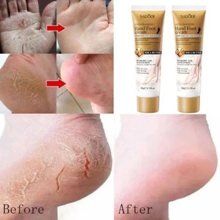 Krim%20Tangan%2060g%20Kering%20Perawatan%20Kaki%20Pecah%20Dan%20Kering%20Perawatan%20Tangan%20Mencegah%20Kekeringan%20Mencegah%20Kaki%20Retak%20Krim%20Pelembab%20Dalam%20Krim%20Perawatan%20Kaki%20-%20Image%203