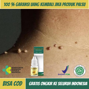 Obat Kutil Papiloma di Leher Obat Perontok Kutil Dileher Obat Penghilang Papiloma Obat Papiloma di Wajah Obat Pengempis Papiloma Obat Kutil Papiloma Obat Skin Tag Kondiloma Obat Penghilang Virus Human Papilloma Dengan Propolis SM