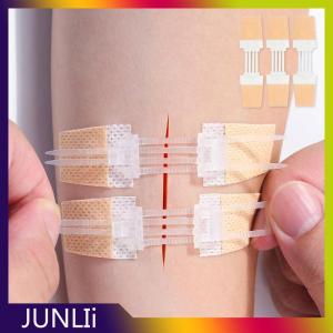 JUNLIi แถบซิปช่วยลดการบาดเจ็บแบบไม่เจ็บรอยเย็บแผลแพทช์แต่งแผลแบบไม่มีตะเข็บตัวช่วยลดการเย็บติดด้วยซิปใช้กลางแจ้งแบบพกพา