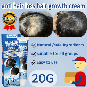 Alopecia hair growth cream 20g Hair fall treatment Hair loss cream Alopecia areata Baldness treat Rapidly repair hair follicles and regenerate hair