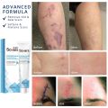 Scar gel remover scar remover cream scar remover for old scar on leg peklat remover cream for old peklat (softens scar tissue and promotes natural skin healing and renewal) ccgray cream. 