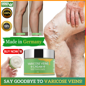 SEFUDUN Varicose Vein Treatment Cream Spider Vein Pain Varicosity Effective Cure Vasculitis 50Grams
