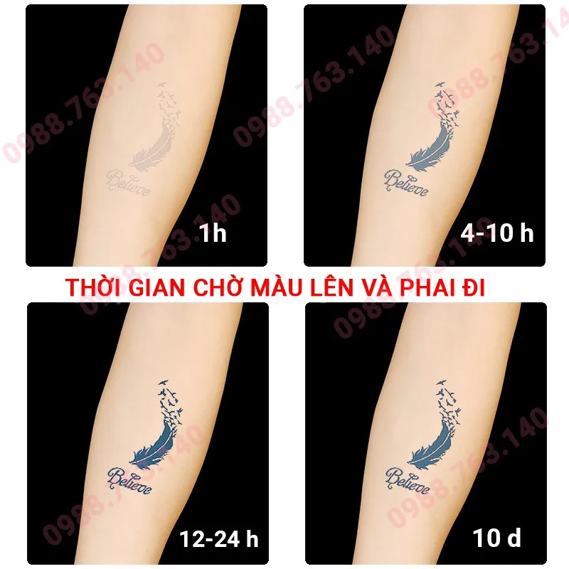 Giải quyết biến chứng sẹo lồi, sẹo phì đại sau khi xóa hình xăm | Nzheal