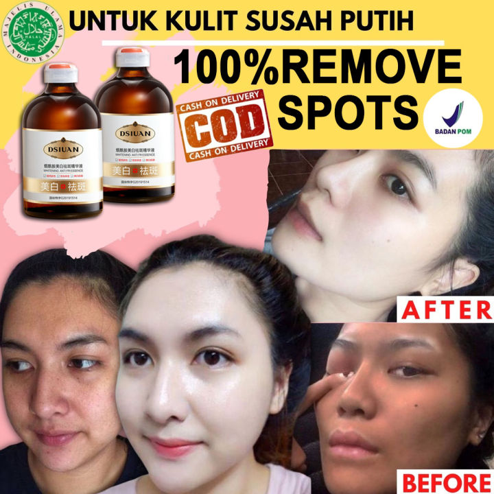 Serum Untuk Flek Hitam 100ml Skincare Serum Wajah Penghilang Flek