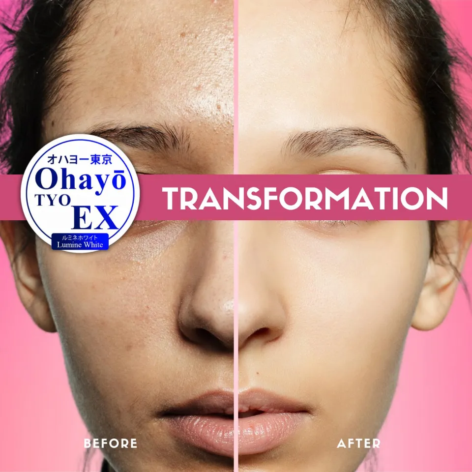 OHAYO TYO Tokyo EX Lumine White 100% MADE IN JAPAN 60 Capsules Glutathione Collagen Vitamin C Zinc Biotin Oral Luxxe Luxee Luxcent Whitening 60-Day Supply Oral Sunblock Supplement - Lazada | Lazada PH OHAYO TYO Tokyo EX Lumine White 100% MADE IN JAPAN 60 Capsules Glutathione Collagen Vitamin C Zinc Biotin Oral Luxxe Luxee Luxcent Whitening 60-Day Supply Oral Sunblock Supplement - Lazada | Lazada PH