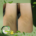 【Set of 3pcs】Miracle Tawas With Calamansi Cream 10g. 
