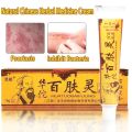 Natural Chinese Herbal Medicine Psoriasis Cream Eczema Psoriasis Antibacterial Antifungal Cream Ointment. 