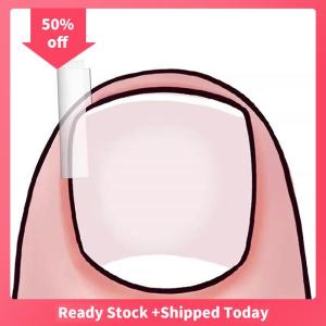 🔥🔥🔥sjqgqx 50Pcs Ingrown Toenail Correction Tool Ingrown Toe Nail Treatment Elastic Patch Sticker Straightening Clip Brace Pedicure Tool