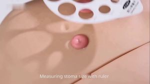 ถุงโคลอสโตมี อุปกรณ์ออสโตมี ถุงระบายน้ำแบบชิ้นเดียวสำหรับการดูแลสโตมาอิเลออสโตมี ขนาด 20 มม.-60 มม. ตัดให้พอดี (ถุง 10 ชิ้น + คลิป 4 ชิ้น + ตัวปิดรูอากาศ 1 ชิ้น + การ์ดวัด 1 ชิ้น)