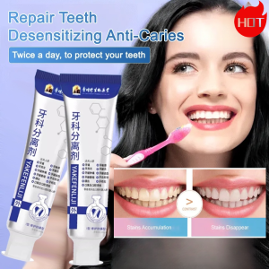 Dental Teeth Cleaner Separating Toothpaste Tooth Separator Toothpaste Non-irritating Formula Safe Separation And Orthodontic Preparation Professional Dental Care Toothpaste Non Irritating