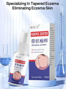 Easy to carry care products Skin Care Solution Rapid absorption Pain relief Mild Nonirritating Banded Eczema Spray/Banded Eczema Spray Skin Care Solution Banded Eczema Skin Care Banded Eczema Spray