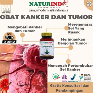 Naturindo Carcinofit Jamu Obat Herbal Kanker dan Tumor Ganas Payudara Serta Serviks Benjolan Pada Tubuh Pendamping Kemoterapi Anti Radikal Bebas Daun Sirsak