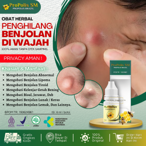 Obat Herbal Untuk Benjolan di Wajah - Obat Oles Penghilang Benjolan di Wajah - Penghilang Benjolan Lemak / Lipoma / Tiroid / Kelenjar / Jerawat / Uci Uci - Obat Benjolan Lipoma di Wajah - Benjolan Lemak di Wajah - Bisul di Wajah - Propolis SM Brazil ASLI
