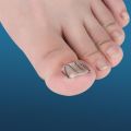 6Pcs Alat Korektor Kuku Kaki Cantengan / Toe Nail Ingrown Pedicure / Nail Corrector / Alat Koreksi Kuku Kaki Tumbuh Ke Dalam. 