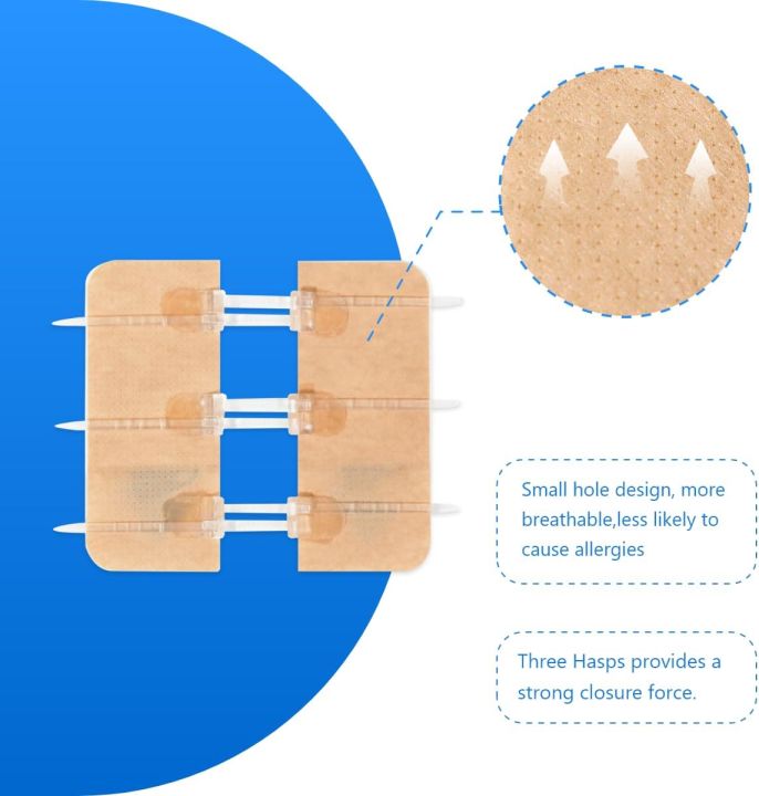 Wound Closure Strips | Secure & Effective Wound Healing - View #8