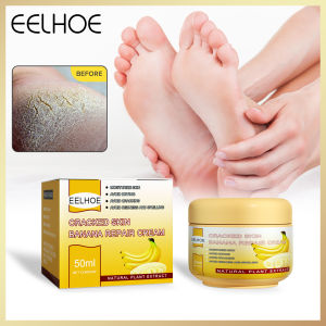 Eelhoe Cracked Skin Repair Cream Natural Banana Oil Anti-drying Crack Foot Cream Heel Cracked Repair Cream Removal Dead Skin Hand Feet Care Anti-cracking Banana Cream Anti-drying Smooth Repair Foot Cream