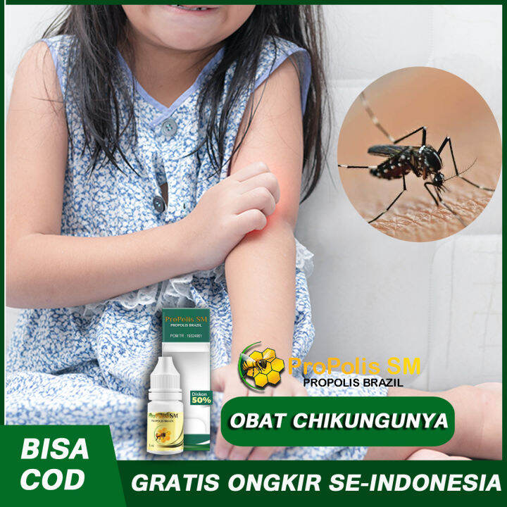 Obat Untuk Chikungunya Cikungunya Ruam Kemerahan Gatal Bintik Merah Di ...