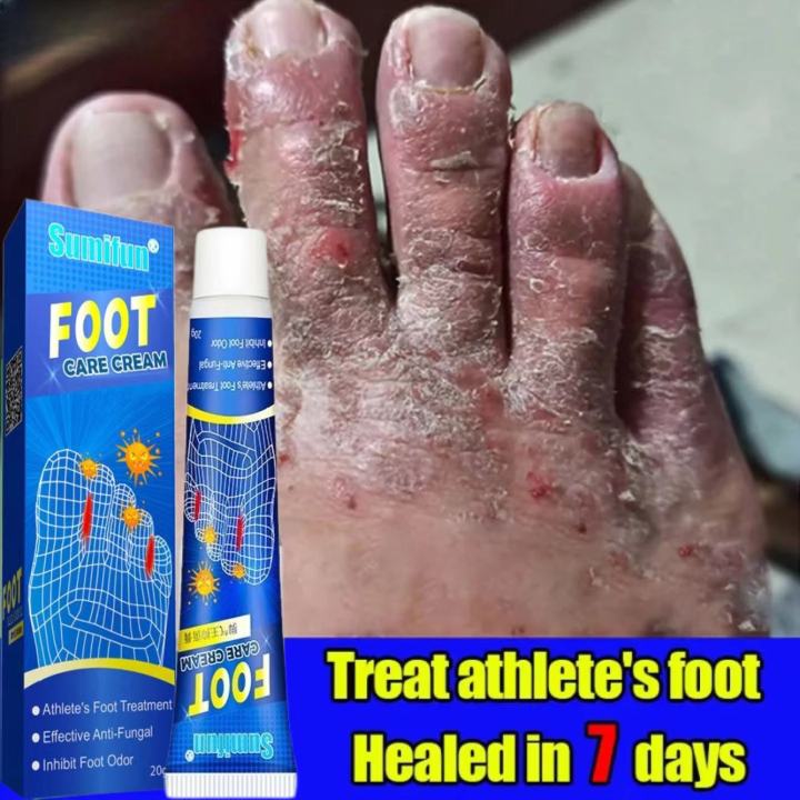Sumilfun Foot Cream Foot Antifungal Ointment Natural Foot Cream