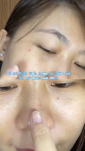 Serum làm dịu da AESTURA A-CICA365 Blemish Relief Serum 40ml chăm sóc làm đẹp kiểu Hàn Quốc