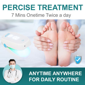 Toenail Fungus Treatment Nail Fungus remove Laser Treatment Device 905nm 650nm Nail Cleaning Laser Device Fungal Infection