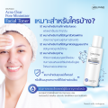 Welpano Acna Clear Pore Minimizer Facial Toner โทนเนอร์ปลอบประโลมผิว รูขุมขนกระชับ เหมาะสำหรับทุกสภาพผิว. 