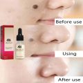 Skin Tag Remover Penghilang Kutil Tanpa Luka Serum Perbaikan Flek Hitam Memudarkan Flek Memutihkan Tanpa Bekas 20ml. 