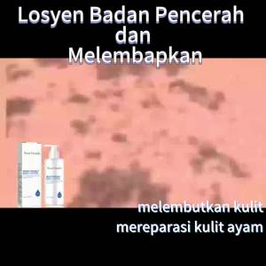 West&Month  Brightening and Moisturizing Body Lotion   Repair Keratosis Pilaris Prevent Dryness Smooth Skin Whitening Beauty