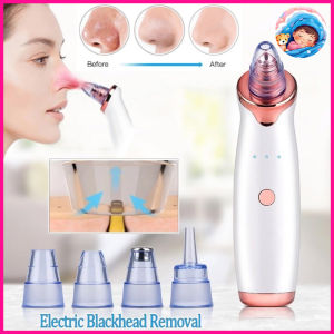 Electric Pore Cleaner for Clear Skin Electric Blackhead Removal Pore Cleaner Machine 吸黑頭粉刺神器