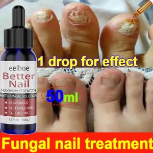 Obat Jamur Kuku Paling Ampuh Nail Repair Essence Serum Ajaib Viral Di Mengobati Kuku Berjamur Dan Rusak 50ml