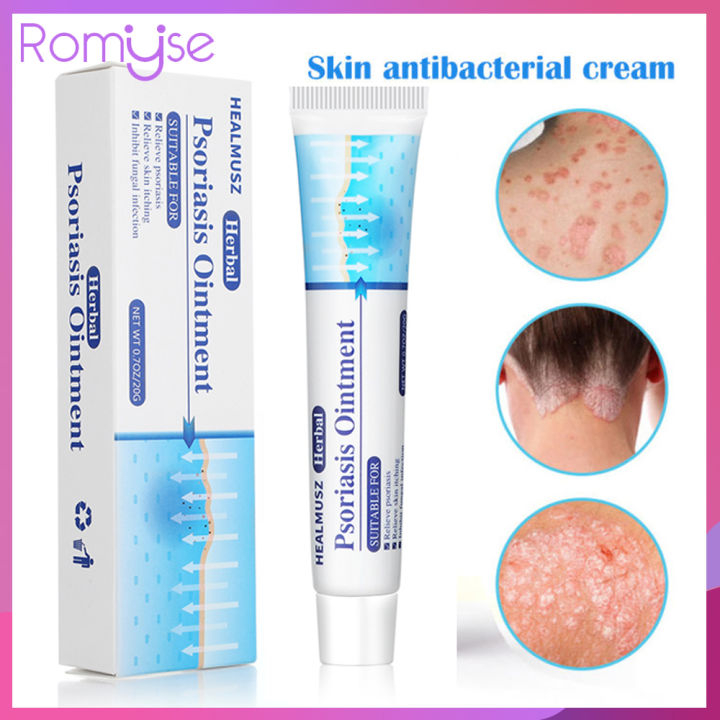 Romyse Psoriasis Cream Antibacterial Medical Ointment Eczematoid ...